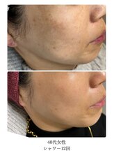 ビジュツ(BIJYUTSU)/プラズマシャワー