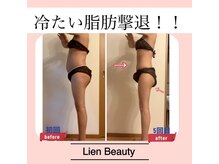 リアンビューティー(Lien Beauty)の雰囲気（【痩身★】脂肪撃退！全身隅々オールハンドリンパドレナージュ♪）