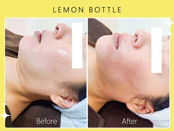 シロカネ 光の森店(SHIROKANE)/レモンボトル☆