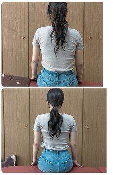 松葉整骨院/肩こり　腰痛　見た目もキレイに