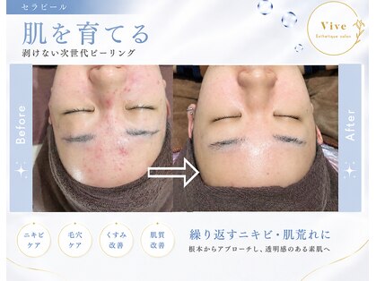 ヴィヴ 三島店(Vive)の写真