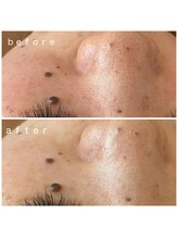 メナードフェイシャルサロン 岐阜茜部/乾燥/毛穴/くすみ