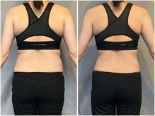 インプルーブ 浜北店(Improve)/体重-5.4kｇ！　30代女性