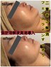 ☆期間限定モニター様☆速攻小顔【お顔の脂肪分解液高速導入】2回券