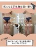 【下半身マジ痩せ120分】キャビ/ラジオ波/RF吸引【豊田発導入キャンペーン】 