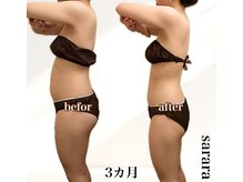 ナチュラル ビューティー スタイル さらさ(Natural Beauty Style)/ブライダル痩身3カ月後