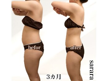 ナチュラル ビューティー スタイル さらさ(Natural Beauty Style)/ブライダル痩身3カ月後