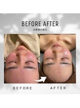 ティースタイル(T-Style)/before/after