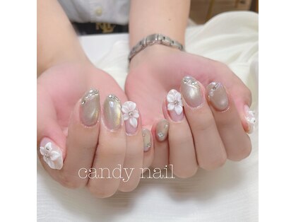 キャンディーネイル(candy nail)の写真