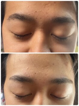 サロン ド アール/眉毛ワックス脱毛