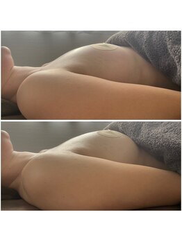 モア(moa)/1回での変化