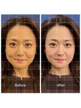 蒼月(aotsuki)/Before/After 