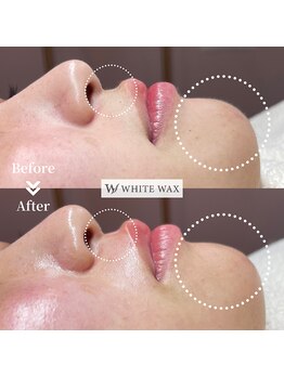ホワイトワックス 浜松(WHITE WAX)/ワックスでお肌のクレンジング