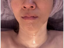 スペシャルリジュランスチームパック１回目＋home care１週目