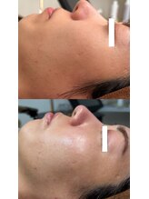 リートライ(Re Try)/プラズマニア