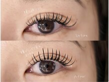 ロヌ(RONU)/エクステパーマ