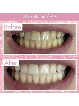 エクシアホワイト 長野店/