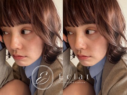 エクラ(Eclat)の写真