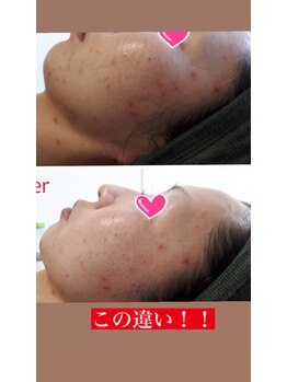 サロンドール(SalonDoll)/トラブル改善へ