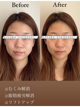 ティアラ(TIARA)/お客様ビフォーアフター