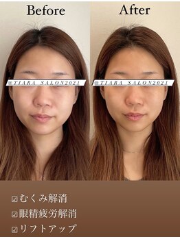 ティアラ(TIARA)/お客様ビフォーアフター
