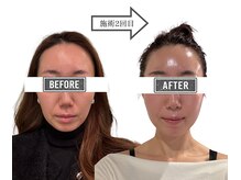 ココンテ(cocon-te)の雰囲気（気になる毛穴は【スイスブリス】肌悩みが減っていく感動をお届け）