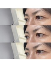 シアミス(SIAMIHS)/まつげ商品