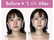 ビジュー(bijoux)の雰囲気(一度の施術で「美肌」も「小顔」も両方が手に入るトリプル施術)