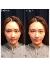 たくろう鍼灸院 豊田本院/Before&After