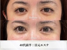 アストリエ グレース 相模大野(Astorie Grace)の雰囲気（【目元エステ変化】まぶた軽やか♪明るくスッキリした目元印象へ）