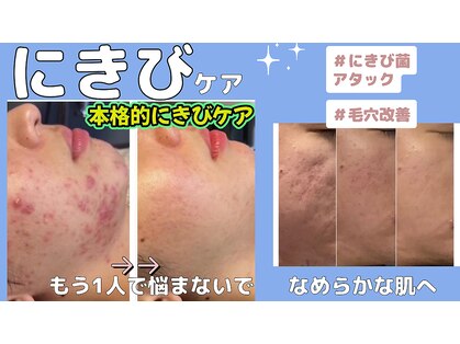 ミライ(Mirai)の写真