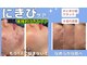 ミライ(Mirai)の写真