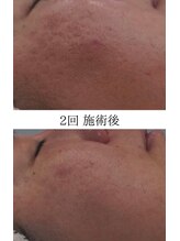 ミスネイル 真玉橋店(Ms.nail)/印象が変わるトリートメント