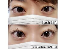 リラ(LILA)
