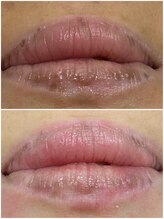 ヒルナム(Heal Nam)/~プロセルセラピーズ~フェイス