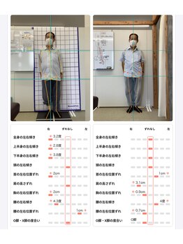なごみ整体院/シセイカルテ