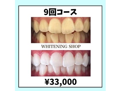 ホワイトニングショップ 倉敷店の写真