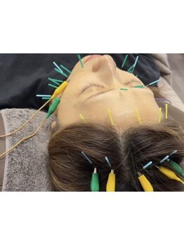 鍼灸施術を受けたい