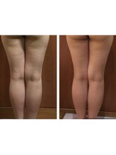 プリンセス バイ セイフティプリンセス 長野店(PRINCESS)/冷えを解消