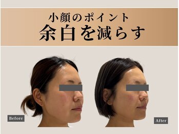 ナチュリ センター南院(NACHUL)/シャープなフェイスラインへ