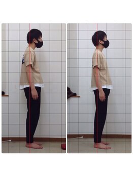 弥富整体院/ビフォーアフター