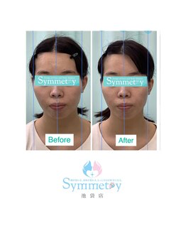 シンメトリー 池袋店/