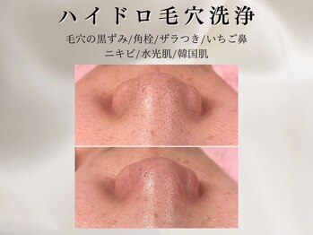 ホワイトラボ 名古屋栄(White labo)の写真/憧れの韓国人のような"艶肌"を目指す＊肌の悩みに合わせた美容液を導入し徹底美白ケア！