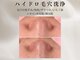 ホワイトラボ 名古屋栄(White labo)の写真/憧れの韓国人のような"艶肌"を目指す＊肌の悩みに合わせた美容液を導入し徹底美白ケア！