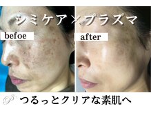 パールホワイトニングサロン 小田原店の雰囲気（当店の強味!シミケアとホワイトニングケアで劇的変化/小田原シミ）