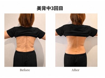 テクテク 鶴見駅西口店(TEQTEQ)の写真/ &nbsp;&nbsp;&nbsp;背中とお腹をゆるめて、軽いカラダと美姿勢へ！