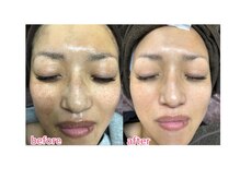 ケースタイル(k.style)/お客様before after