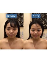 アジール 長岡リバーサイド千秋店(agir)/Before/After画像