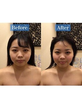 アジール 長岡リバーサイド千秋店(agir)/Before/After画像