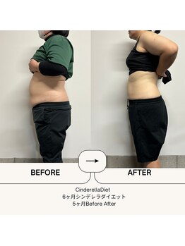 オーシャン整骨院(OCEAN整骨院)/6ヶ月コース